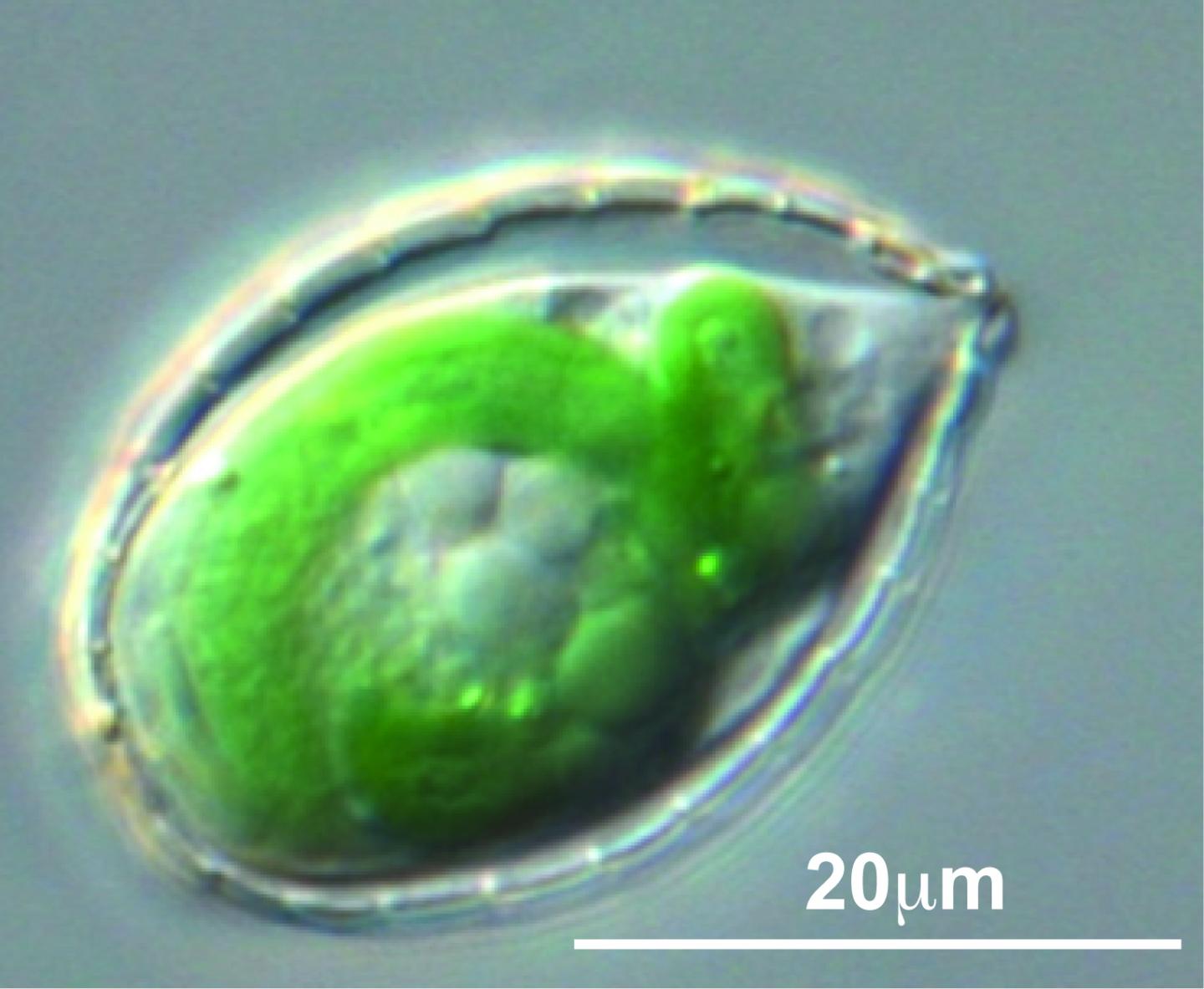 The Amoeba <i>Paulinella</i>