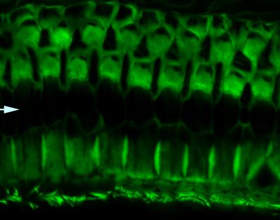 Claudin-9 Mutation Can Lead to Damaged Hearing