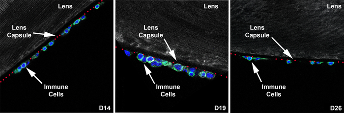 Immune cells on the eye.