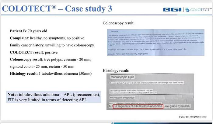 BGI Genomics Colorectal Cancer Patient Story - Hanka