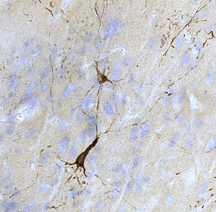 TBI Hallmarks in Muskox Brains