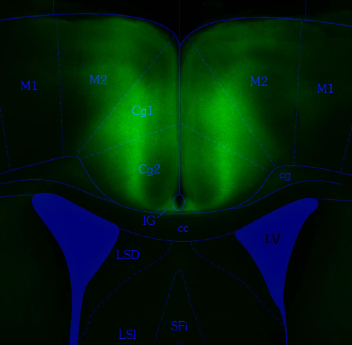 Brain cells switched off in the anterior cingulate cortex (green) prevent mice from learning flexibly.