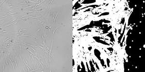 Fibroblast cells migration as part of a wound healing assay