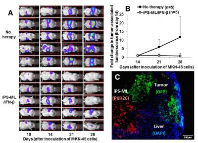 Metastatic Liver Cancer Therapy Using iPS-ML/IFN-β in a Murine Model