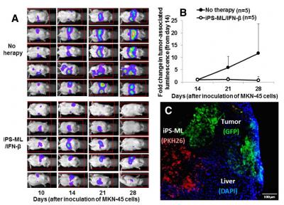 マウスモデルにおけるiPS-ML/IFN-βを用いた転移性肝がん治療