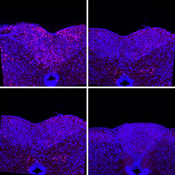 area postrema before vs. after [IMAGE] | EurekAlert! Science News Releases