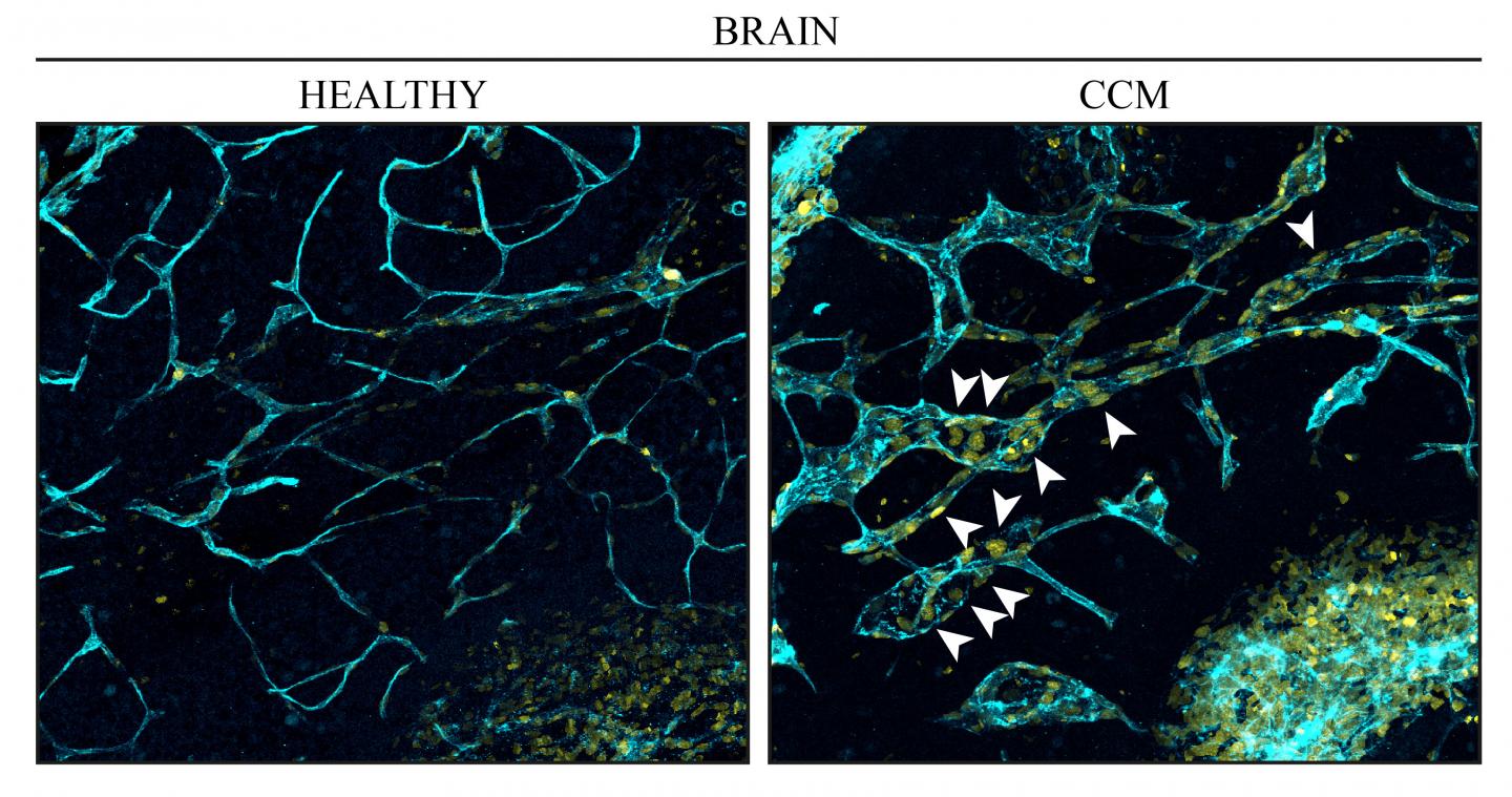 CCM Mouse Brain