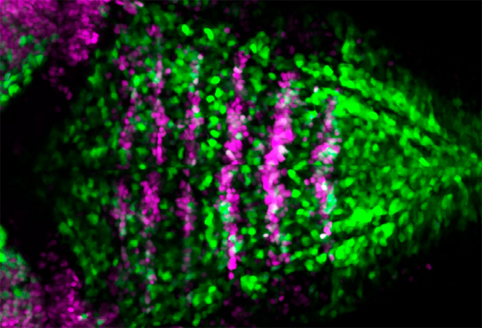 Figure CEP: Notch activity (green) in embryonic brain stem cells (magenta).
