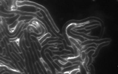 Toxic Protein Inhibits Cell Wall Synthesis in Rival Bacteria