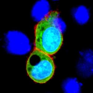 Cell-based assay to detect the anti-NRXN1 autoantibody