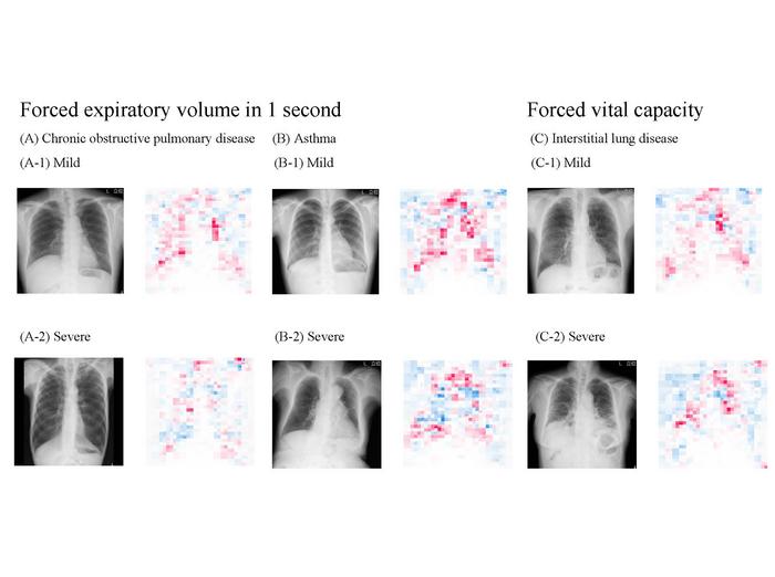 Chest radiographs and average saliency maps