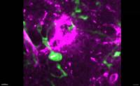 Microglia Cell Entering Perineuronal Net