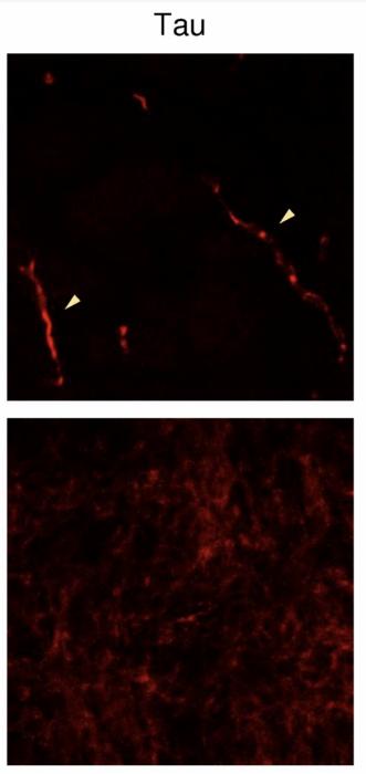 Confocal images