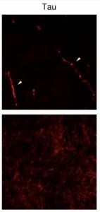 Confocal images