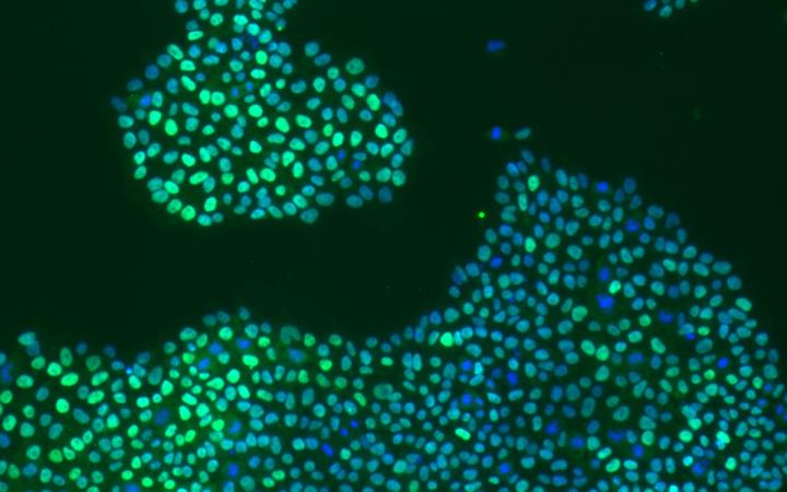 STSI Study Induced Pluripotent Stem Cells