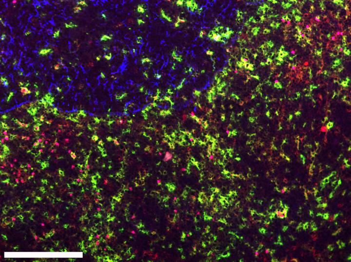 Dendritic Cells Make Leukemia Grow