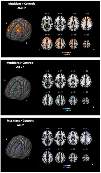 fMRI