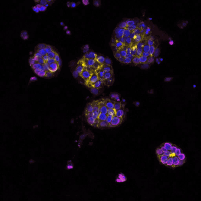 Breast Cancer Organoid Gif