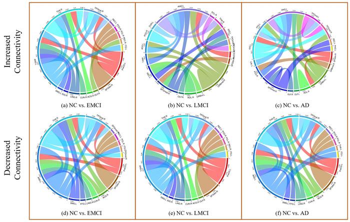 Visualization of altered connections at different stages of Alzheimer's disease