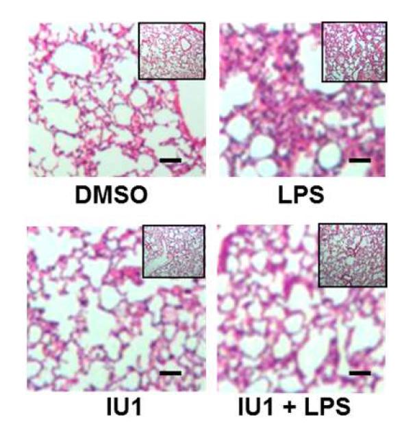 A New Target to Prevent Sepsis