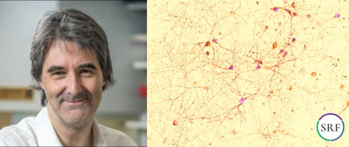 Michael Courtney and SYNGAP1 distribution in field of hippocampal neurons