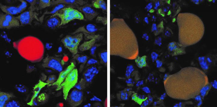 Cancer to Adipocyte Conversion