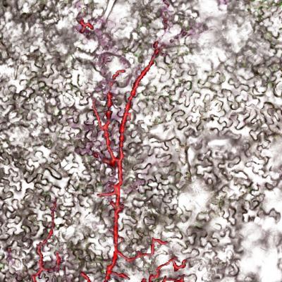 <I>Phytopthora infestans</I> Hypha