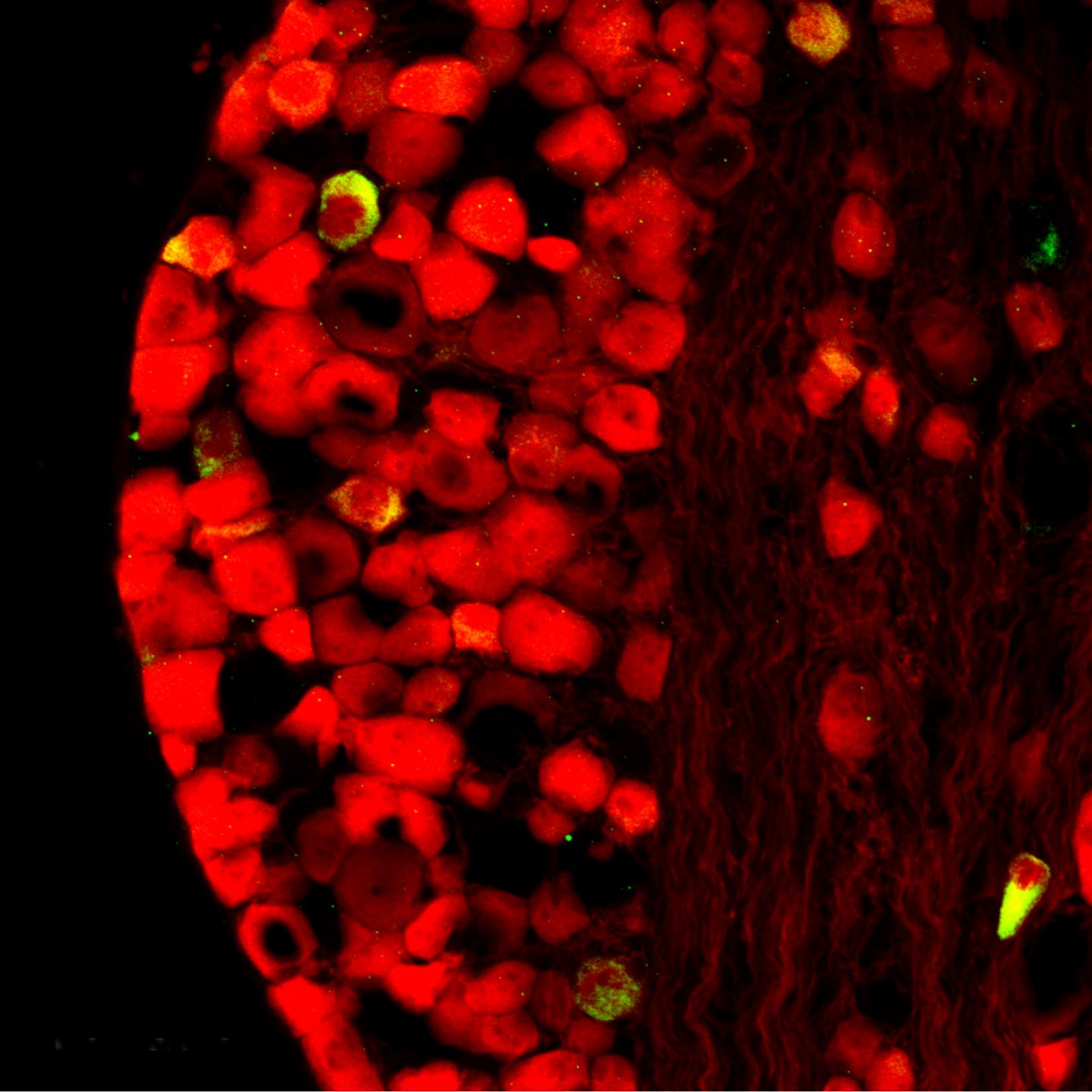 tdTomato (red) expression in nodose neurons