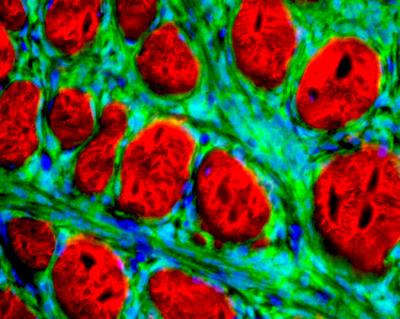Synovial Sarcoma in Mice