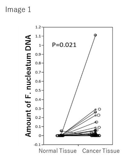 <em>F. nucleatum</em> DNA Content in Cancerous & Normal Tissues