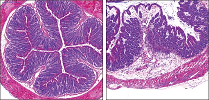 Antibiotics Increase Susceptibility to <em>Listeria</em> Infection