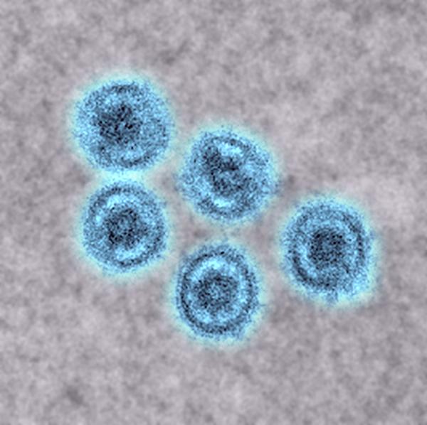 Reston virus particles