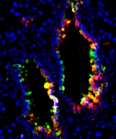 Slowing the Allergic March