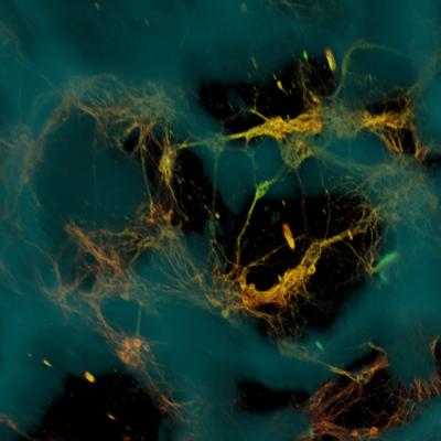 Neuronal Networks Anchored to Scaffold