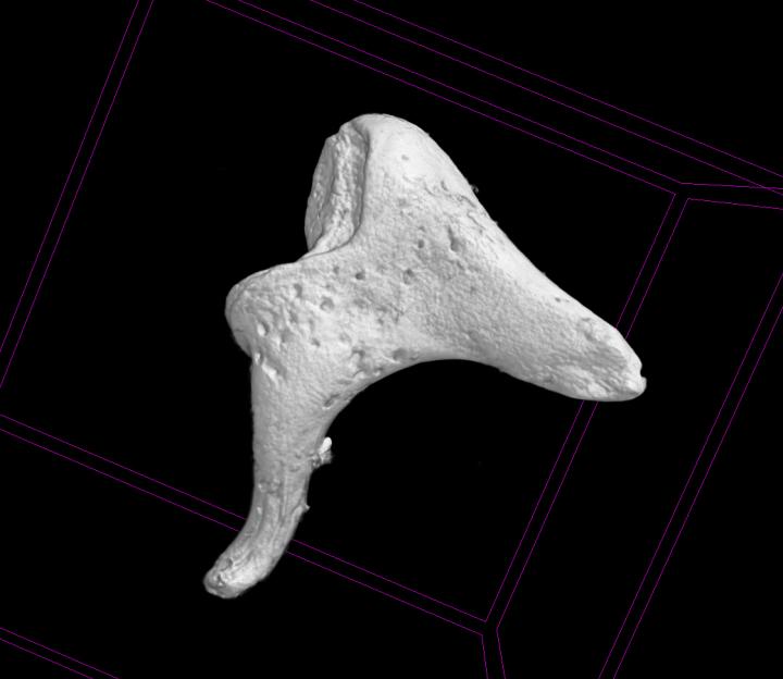 Scan of Ossicle Bone