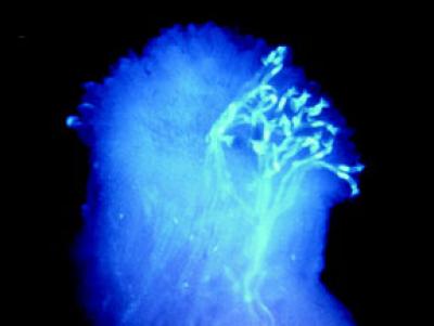 Tracking Genes for Self-Pollination in Arabidopsis