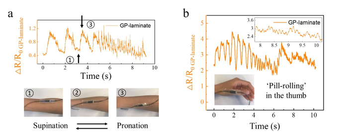 Fig.4 Using GP-laminate for monitoring mimicked movement disorders.