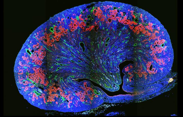 Cross Section of a Cystic Kidney