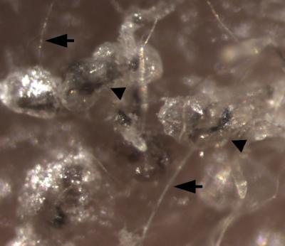 Converting Adult Human Cells to Hair-Follicle-Generating Stem Cells