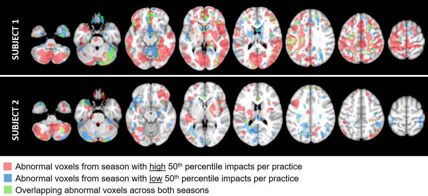 Imaging data from two youth football athletes