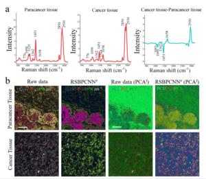 Clinical tissues hyperspectral image spectral preprocessing.