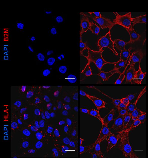 B2M Immunofluorescence