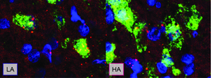 The dopaminergic neurons of low-anxiety rats