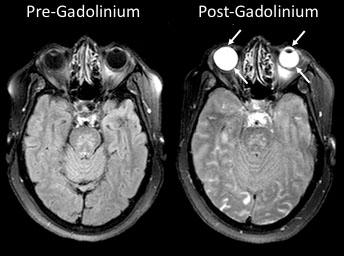 Eyes Yield Information about Strokes