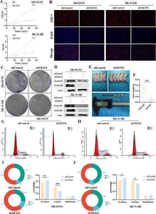 TKT controls neuroblastoma cell growth in vitro and in vivo.