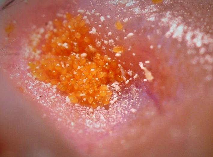 Chigger Aggregation [IMAGE] EurekAlert! Science News Releases