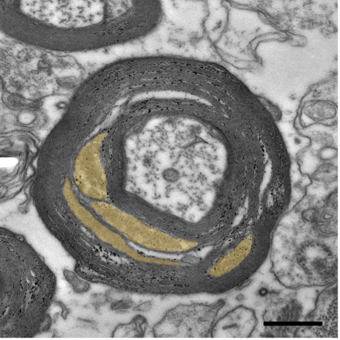 Electron microscope image of a nerve fiber with myelin