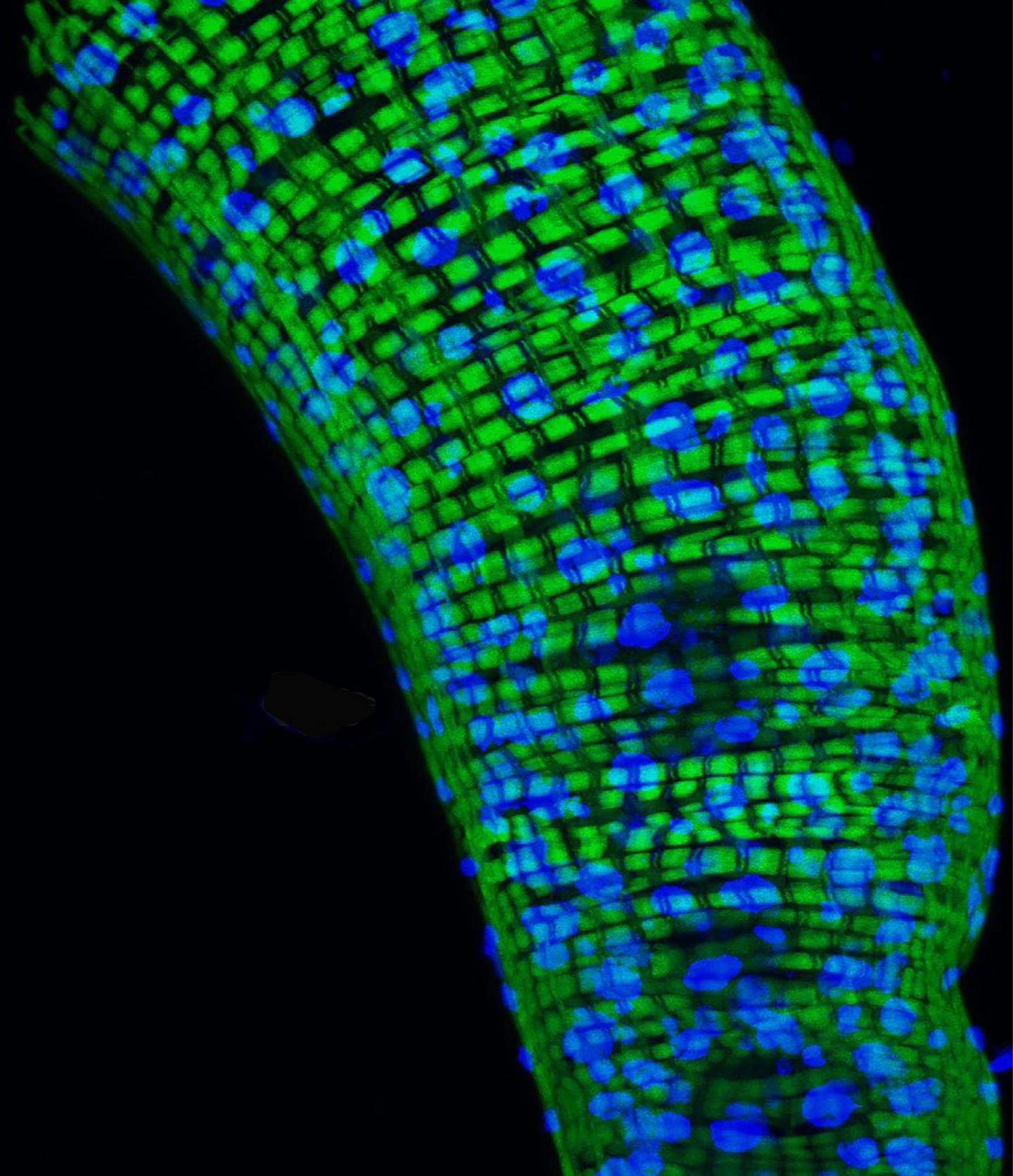 Genes, Bacteria and Aging Flies