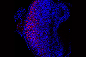 Fly larva eye