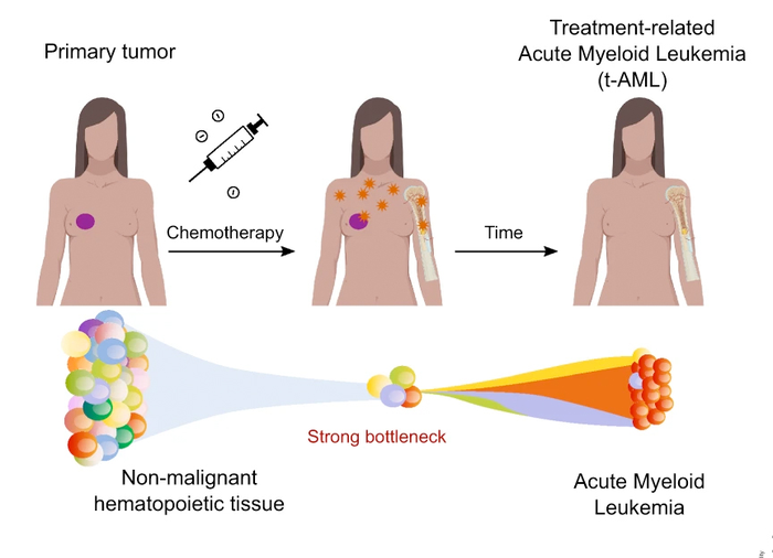 Treatment related Acute Myeloid Leukimia